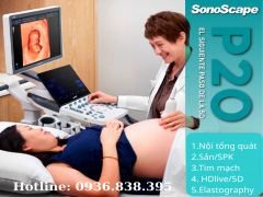 Vì sao máy siêu âm Sonoscape được nhiều bác sĩ khởi nghiệp tin tưởng chọn lựa?